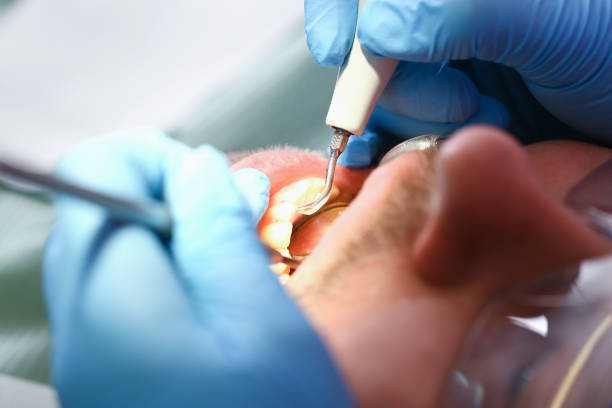 Best Emergency Treatment for Toothache in West Wyomissing, PA