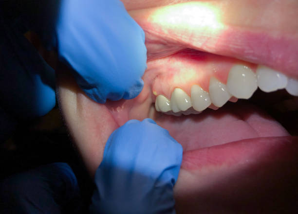  West Wyomissing, PA Emergency Dentist Pros