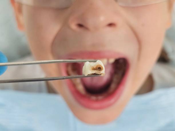 Best Emergency Broken Tooth Repair in West Wyomissing, PA